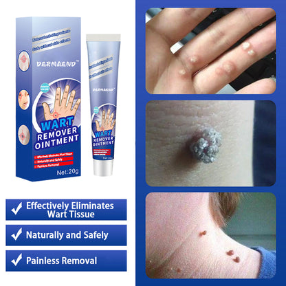 DermaEnd™ Wart Remover Herbal Ointment 100% Natural