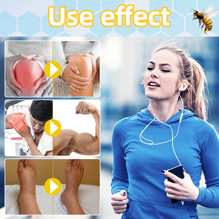 🧊Thonesr™ Bee Venom Freeze Spray (New Zealand Bee Extract - Specialized in the treatment of orthopedic diseases and arthritis pain)