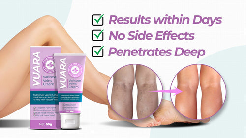 Vuara™ Varicose Veins Cream