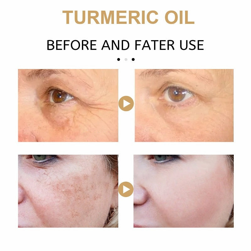 TurmaX™ Turmeric Spot Correcting Serum