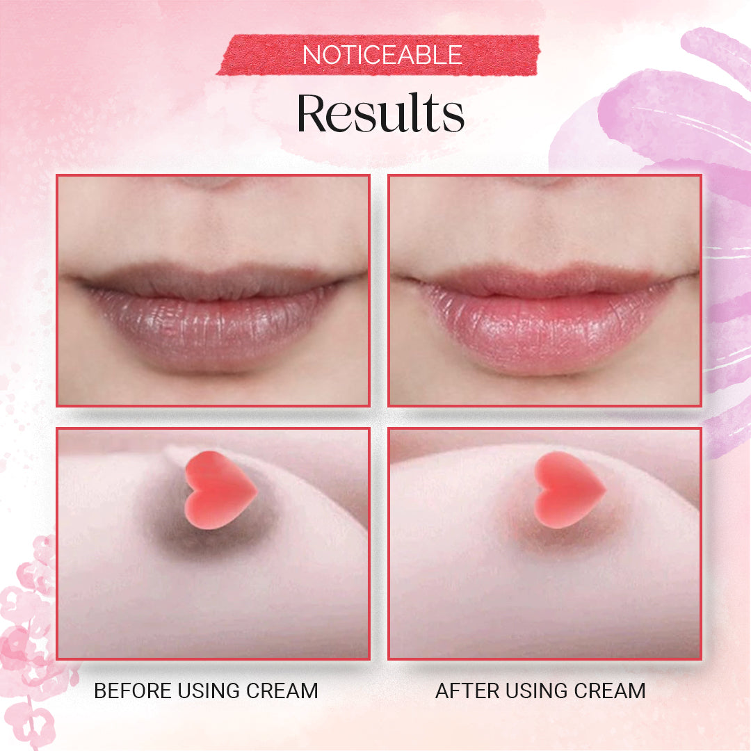 Women Pink Skin Pigmentation Removing Cream